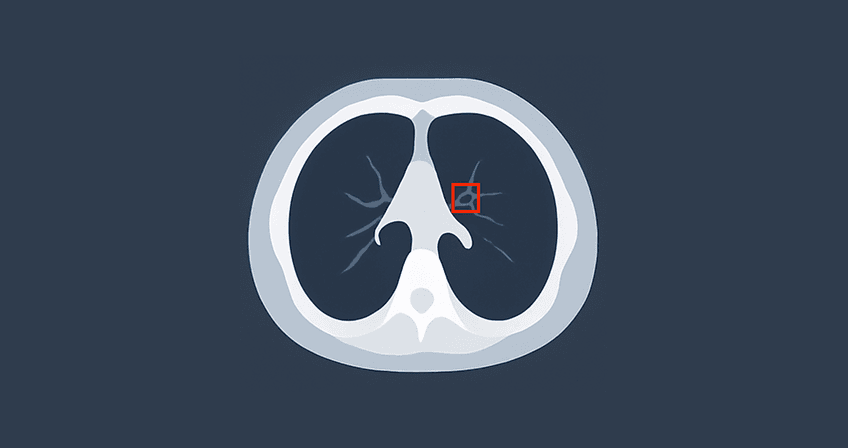 A feature image of the article.